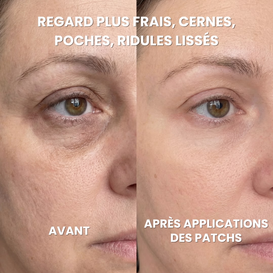 Patchs Hydrogel Anti-Cernes - Caféine, Collagène, Niacinamides